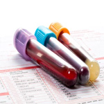 Blood Screens Check, Health And Drug Checks